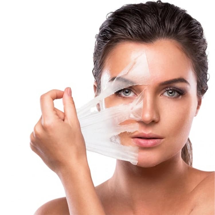 Acne & Scar Treatment