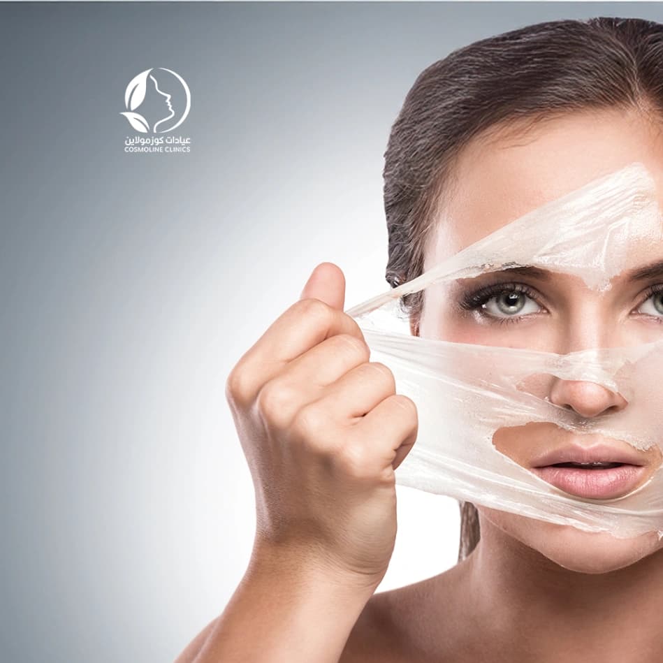 Cold Peeling Face